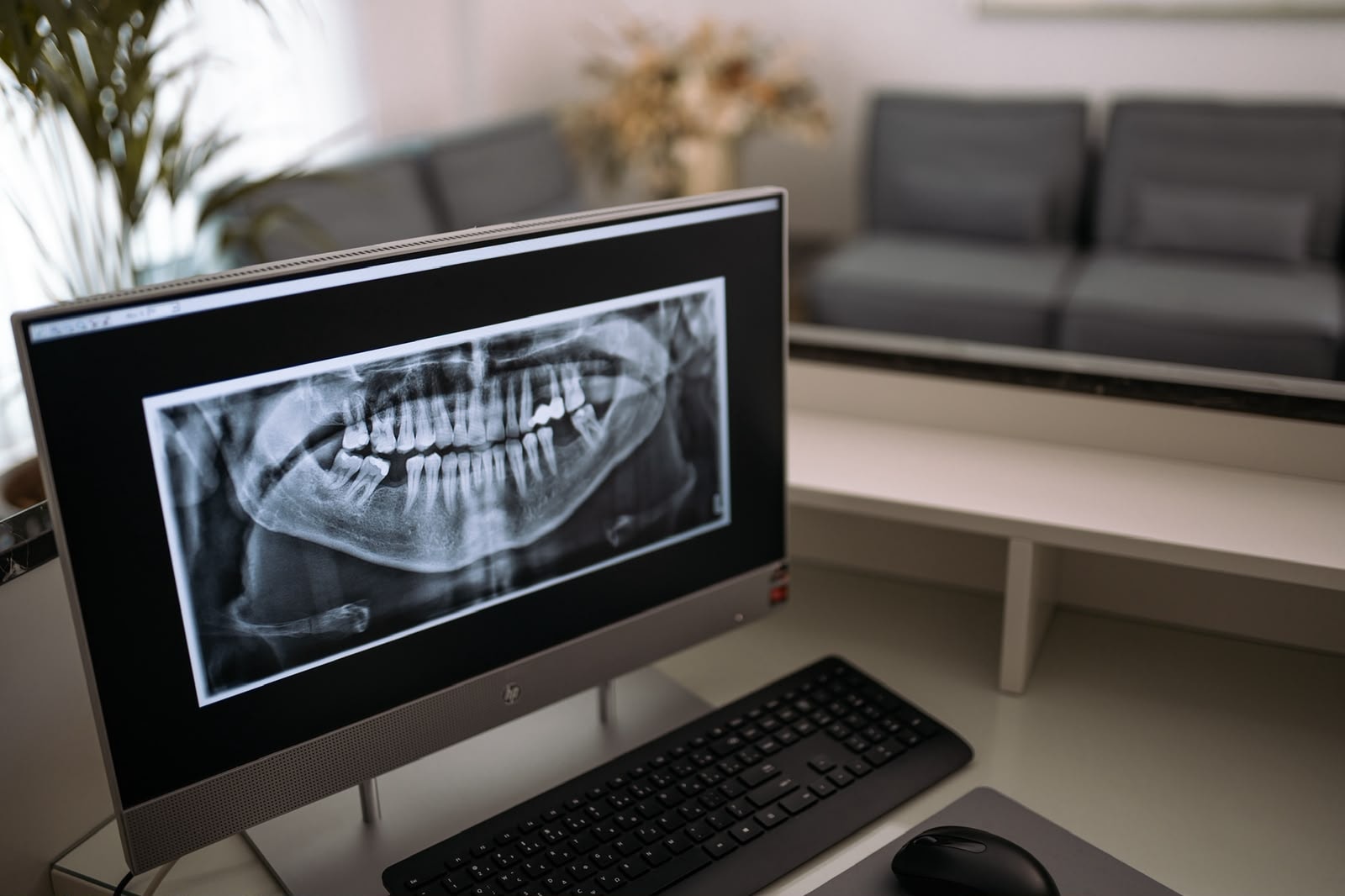 A panoramic X-ray on the consulting screen